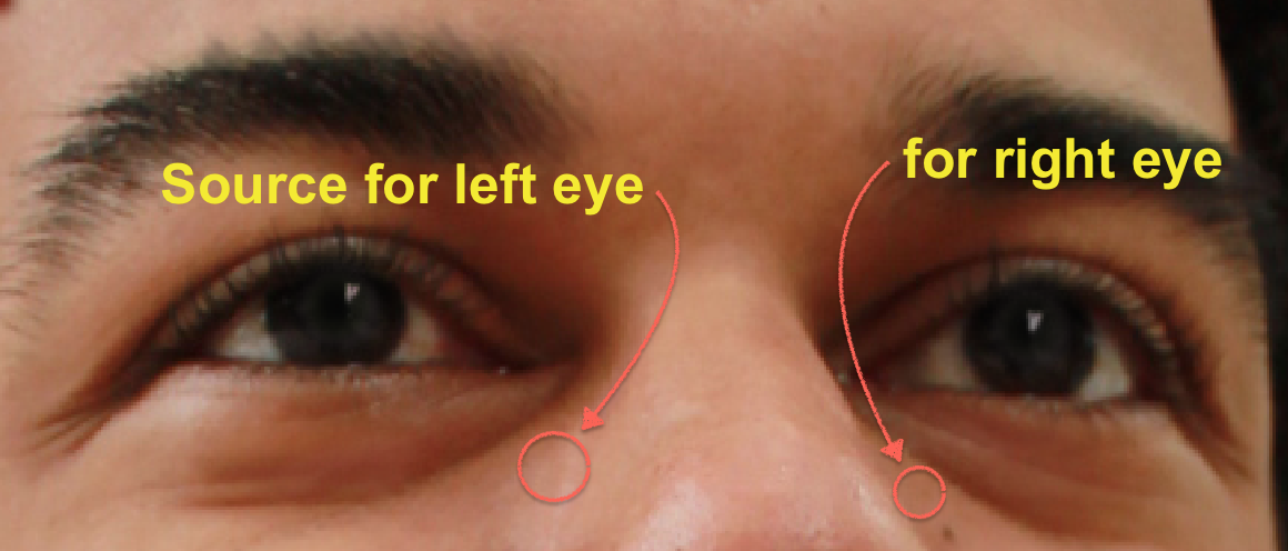 Good sources for the left and right eye are the inner portion of the eye (below the dark circles) 